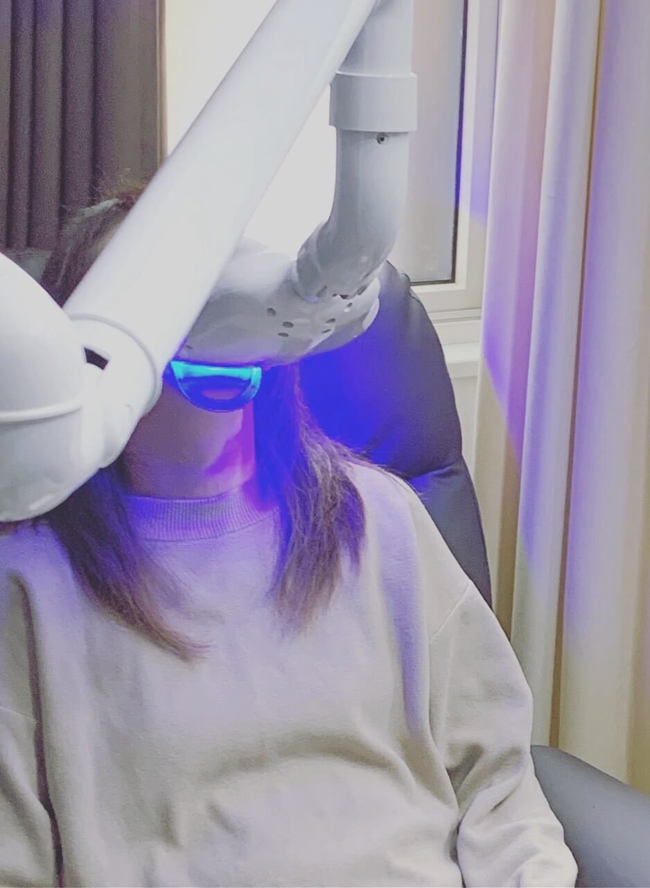 ホワイトニング機材イメージ